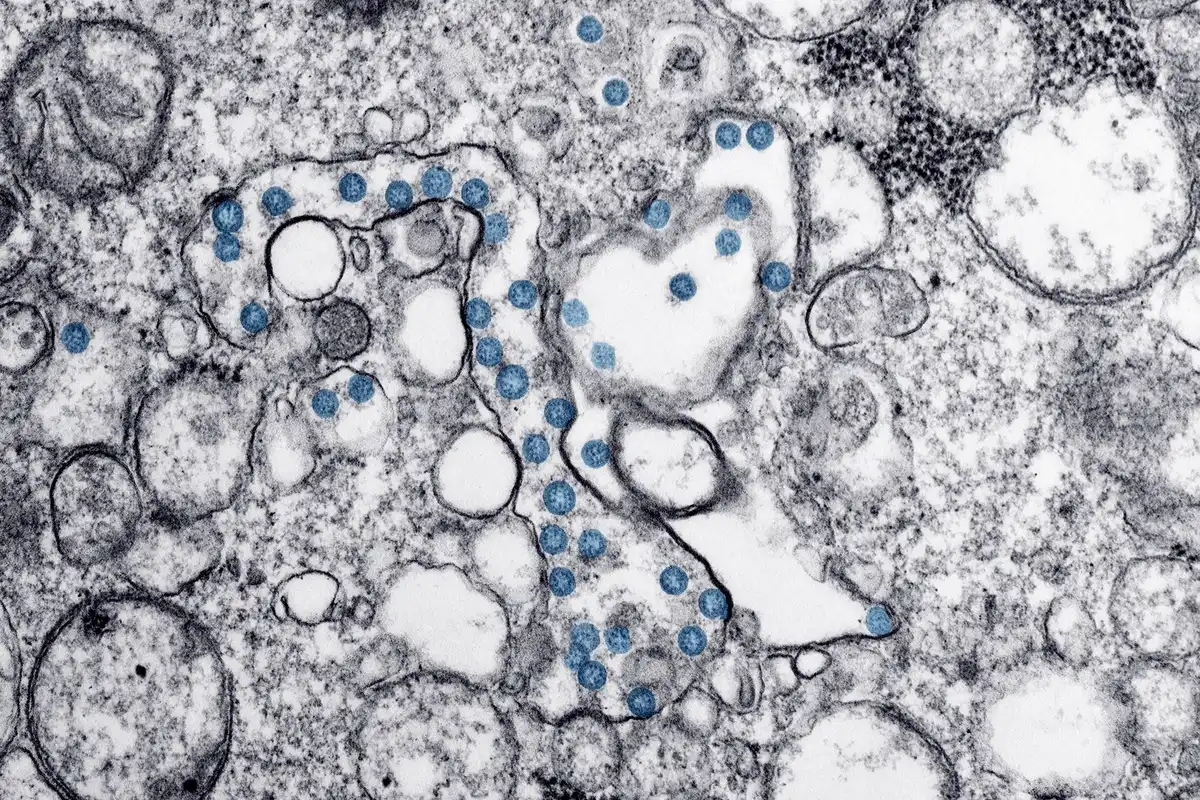 Mikroskopiese beeld van Cyclospora-parasiete wat siklosporiasis veroorsaak